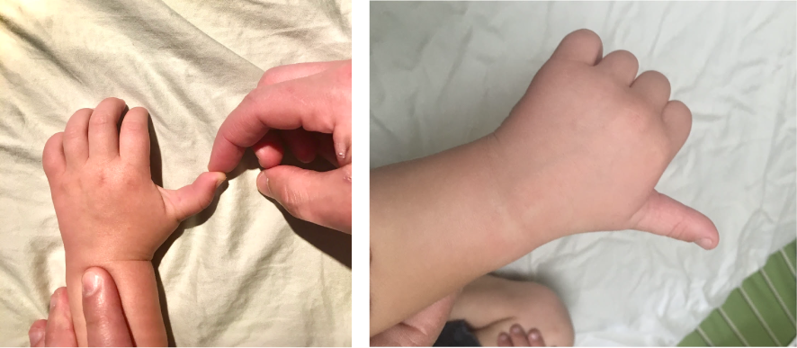 acupuncture traditional chinese medicine houston